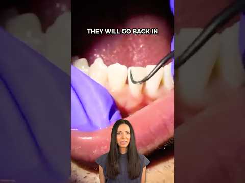 scaling teeth with ultrasonic water #shorts #dentist