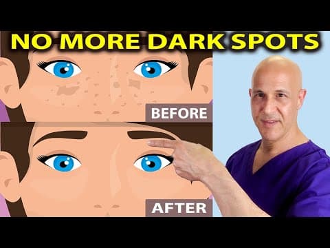 Brighten Your Skin:  How to Lighten Dark Spots with Everyday Ingredients!  Dr. Mandell