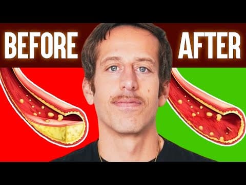 Top 5 Best Vegetables To Unclog Arteries Naturally & Prevent A Heart Attack | Ben Azadi