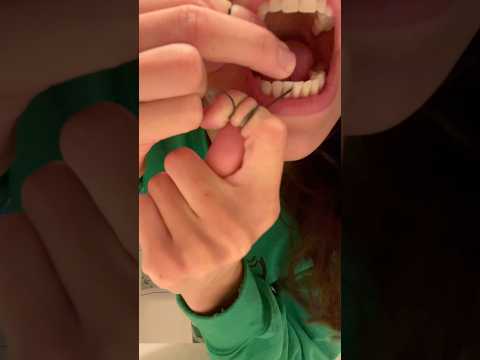 dental hygienist’s teeth after hot chocolate #shorts