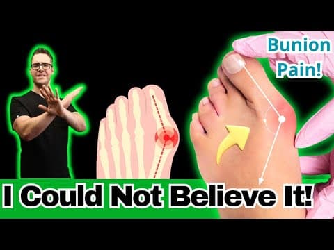 How To Get Rid Of Bunion Pain! [Top 10 Home Treatments]