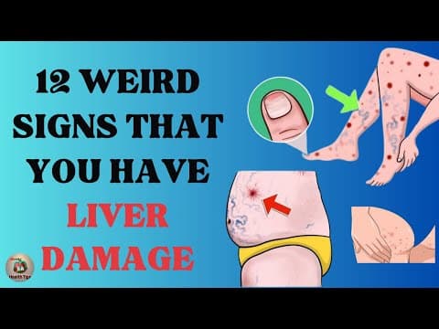 Warning: 10 Weird Signs That Show You're Having Liver Damage