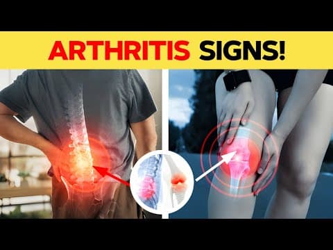 A Silent Threat:  8 Signs That Could Indicate Osteoarthritis