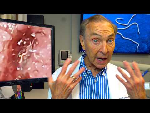 WORMS In The Mouth! Rare Infestation In The Tongue and Gums 🪱