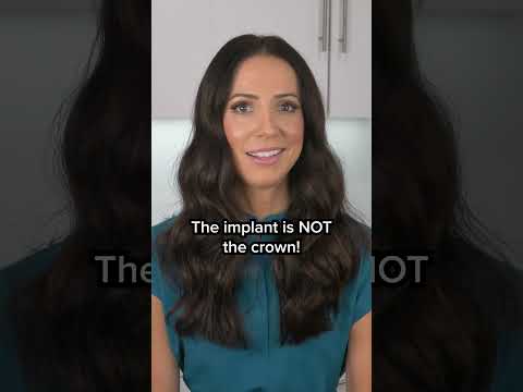 dental implants explained #shorts
