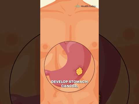 Is Burping a Lot a Cancer Sign? #cancer #signs #health