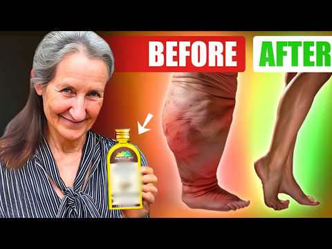 Get Rid of SWOLLEN Feet & Legs FAST with Barbara O'Neill's Secrets!