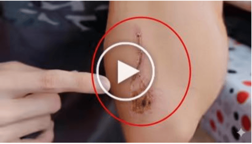 The Reason Your Blood Sugar Issues Continue Despite Best Efforts