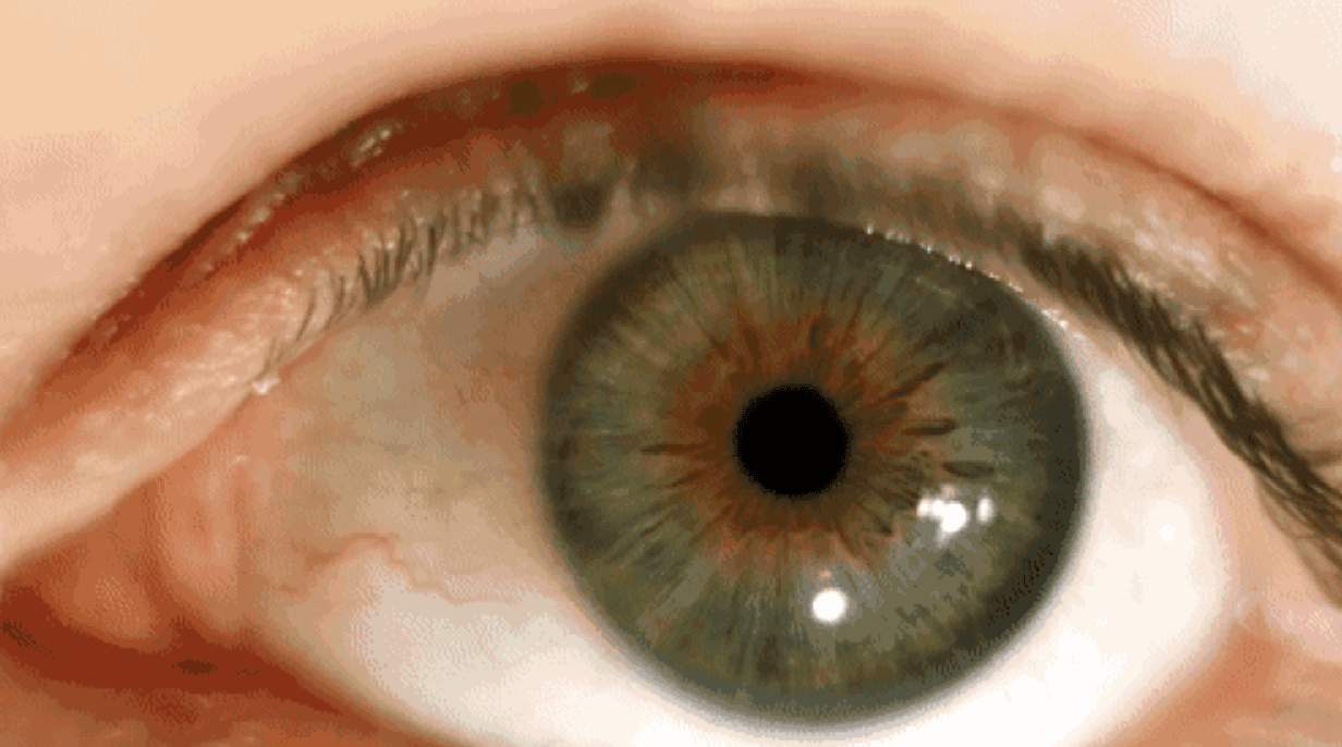 What Your Optometrist Isn’t Telling You About Blurry Vision