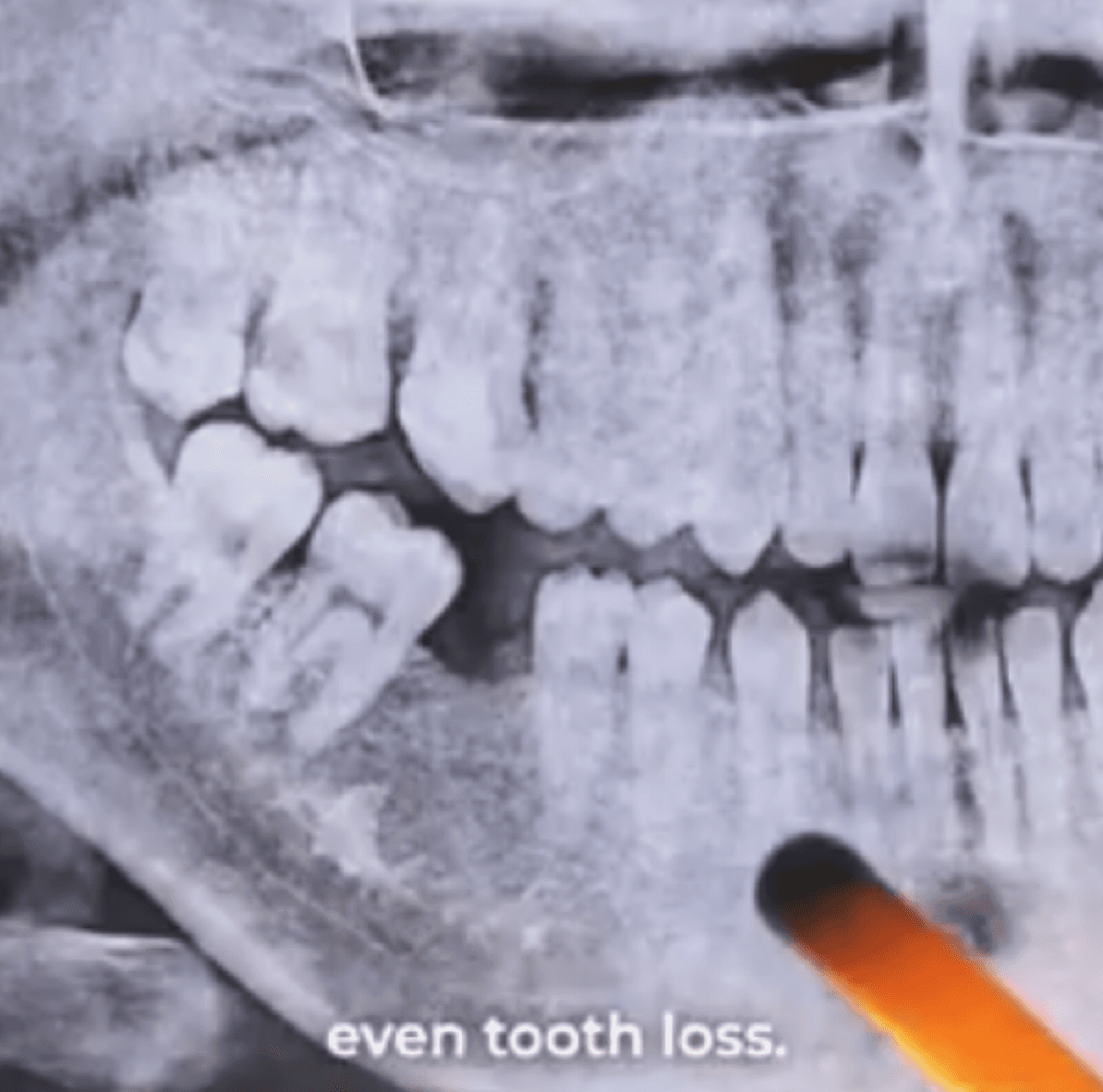Say Goodbye to Gum Problems with This Quick 30-Second Technique