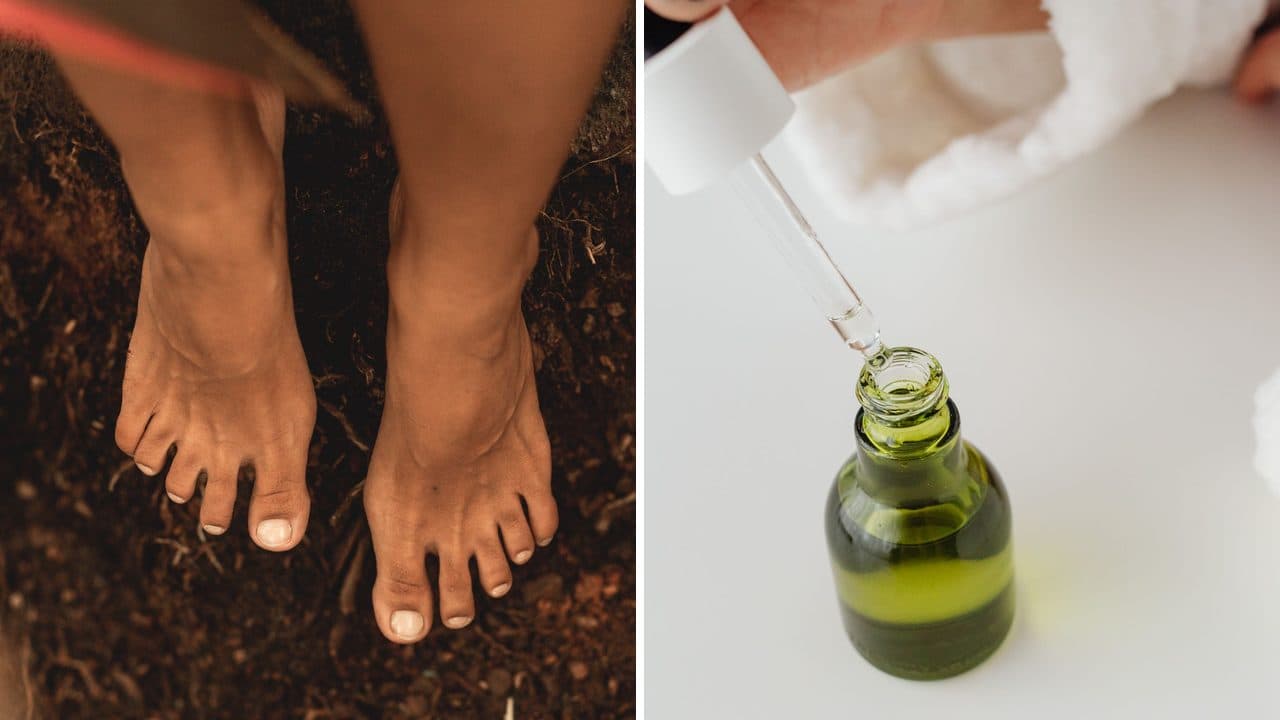 Why Toenail Fungus Returns Again and Again (It May Not Be Your Fault)